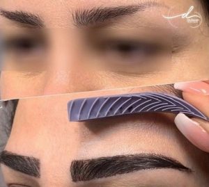 EyebrowTransplant